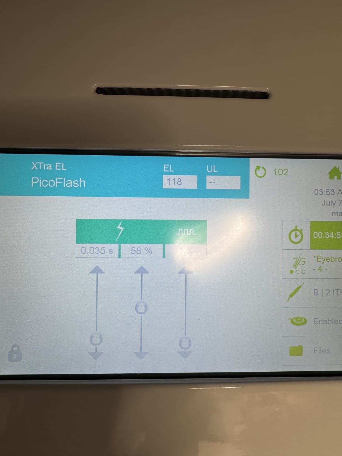 A close-up of flash-thermolysis timing settings, roughly 0.035 seconds at 58%.